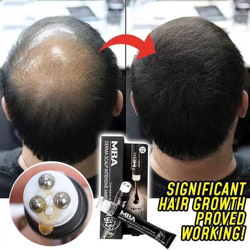 Roll-on Hair Growth Serum